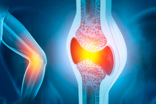 Профилактика на ставни заболявания